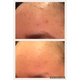 ミディアム ニキビ跡専門サロン Ａｉｎａのエステ・リラクイメージ