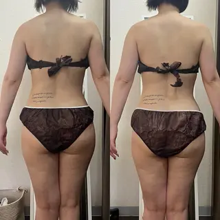 ハイパーナイフ専門店　Salon de COCO所属・Salon de COCOのエステ・リラクイメージ