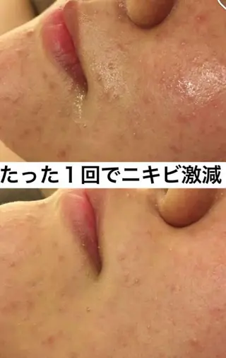 ミディアム マツエク・マツパ ニキビ・肌質改善専門 ♡人生が変わるサロンのエステ・リラクイメージ