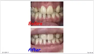 セルフホワイトニングサロン　ラヴィアン所属・ホワイトニングサロン La vie enのその他イメージ