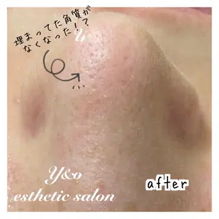 〜小顔・痩身・リラクゼーション〜　　Y&o Esthetic  Salon所属・HANA MIKIの眉毛・アイブロウイメージ
