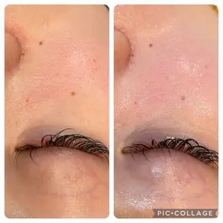 leolo武蔵浦和 肌質改善＆脱毛のエステ・リラクイメージ