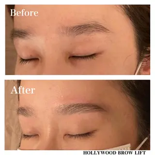 アイブロウ Ｂ&H所属・頭痛•肩こり専門/ 眉サロンB&H心斎橋のエステ・リラクイメージ