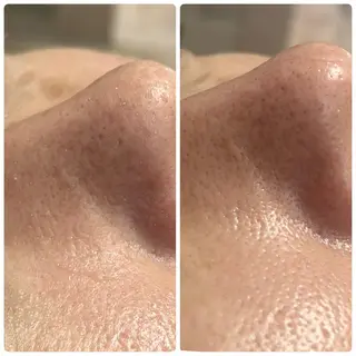 beautysalon LINO所属・平日昼間限定★ 全メニュ¥6600のエステ・リラクイメージ