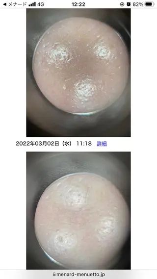 メナードフェイシャルサロン天王寺駅東口代行店所属・メナード天王寺駅東口 稲冨恵美のエステ・リラクイメージ