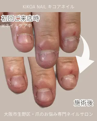 ネイル KIKOA NAIL キコアネイルのネイルデザイン