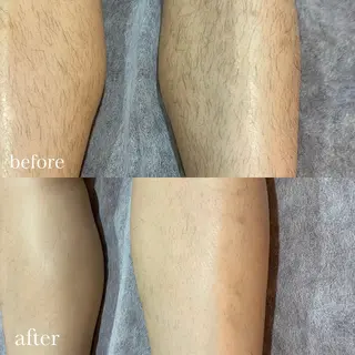 脱毛専門サロンElixir加須店所属・脱毛専門サロン Elixir　加須店のエステ・リラクイメージ