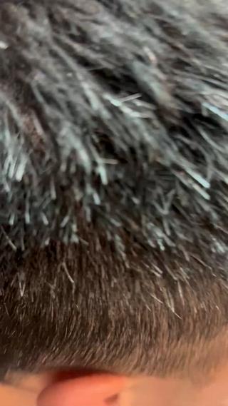 6ミリ、3ミリのグラデーション
バリカンだけでつくる刈り上げ