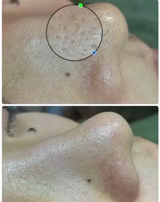 private salon  Dea_maris シュガーリング＆パーソナルボディケア所属・シミ改善・韓国肌管理 ボディメイク痩身のその他イメージ