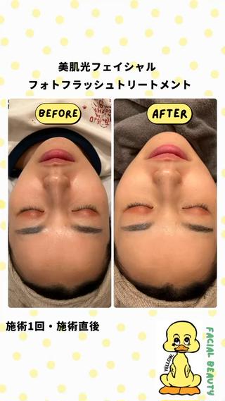 yellow.所属・yellow💛【 脱毛&フェイシャル】のエステ・リラクイメージ