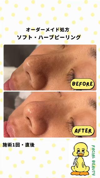 yellow.所属・yellow💛【 脱毛&フェイシャル】のエステ・リラクイメージ