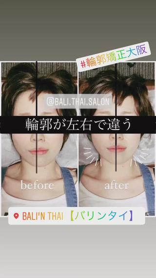 🌈歪み改善🌈 バリンタイ すぎうらのエステ・リラクイメージ