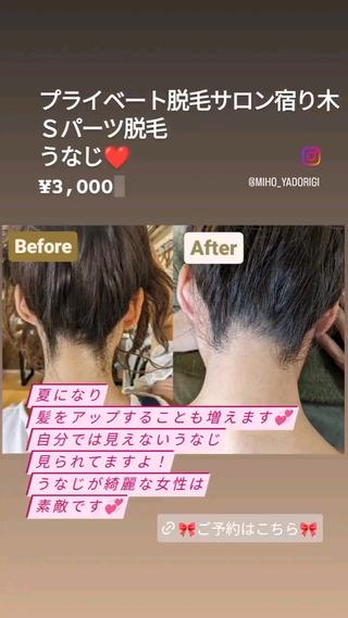 プライベートサロン宿り木所属・江坂@宿り木　脱毛＆ 耳ツボジュエリーのその他イメージ