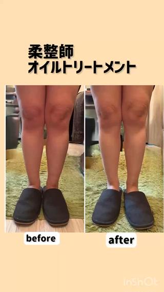 柔道整復師がおこなう
オイルトリートメントにてかわです

疲労の放置は病気ケガのきっかけ という
考えのもと施術しています。

健康の先に美容があるので、まずしっかり疲労を取りましょう。

手技は①筋肉の両端を意識してほぐしたり、②横向きから立体的にアプローチしたり、
③バストから肩甲骨をほぐしたりしています。

独自の手技です
 