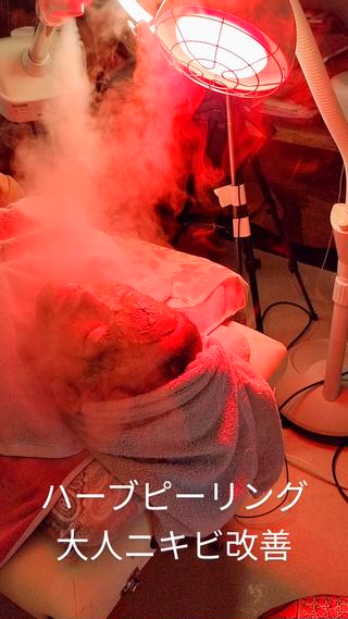 ☺ハーブピール💕 ソフィアカロン💖のエステ・リラクイメージ