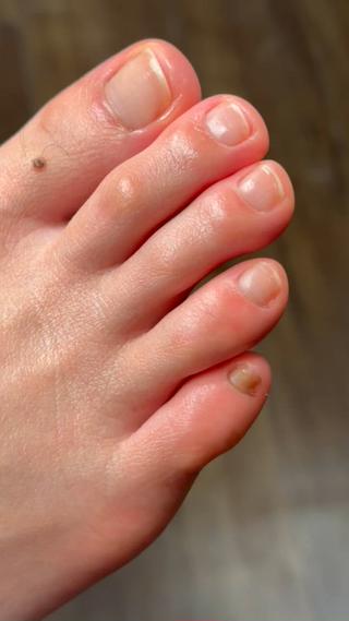 フットのケアをさせていただきました。
お写真にお付き合いくださいましてありがとうございます。