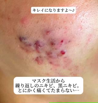 Ailes トータルビューティーのエステ・リラクイメージ