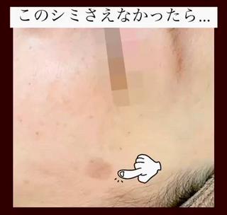 Ailes トータルビューティーのエステ・リラクイメージ