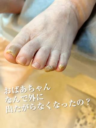 「外に出たがらないのは、歳のせい」…本当にそうでしょうか？

実はそれ、「足」に原因があるかもしれません。

︎ 歩く時に痛い
︎ 爪が当たって気になる
︎ 転びそうで怖い

これらのちょっとした「足の不快感」が、外出する気持ちをそいでしまうこと、よくあります。

足元を整えることで「ちょっとそこまで行ってみようかな」そんな気持ちが戻ってくることも

大切なご家族の「自分の足で歩く時間」を、いつまでも続けていけるように。 