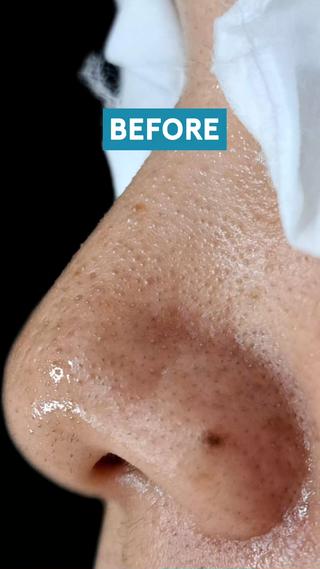 美肌脱毛サロン つるりと御殿場店所属・美肌脱毛サロン つるりとのその他イメージ