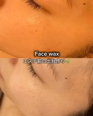 Joo🌿肌育/高岳 アトピー/肌質改善のエステ・リラクイメージ