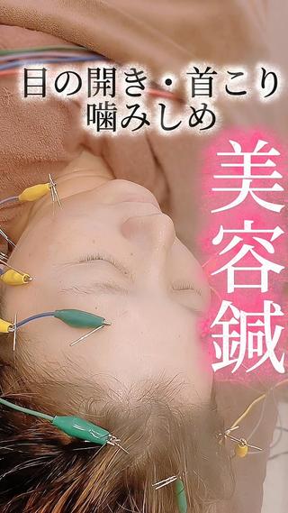 美容鍼 