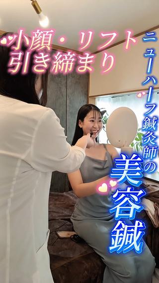 美容鍼 