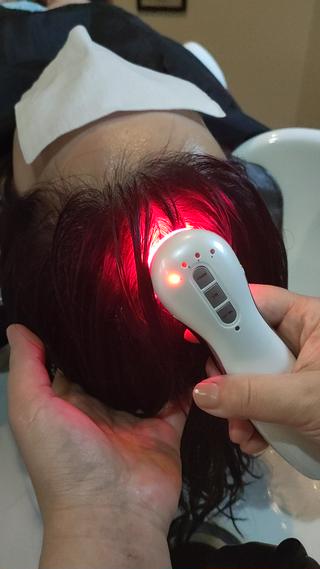 ヘッドスパと併用し、ヒト幹細胞培養液を専用ポレーションを使用し、浸透させます。１ヶ月毎に繰り返す事で、髪にコシやハリが出て健康な髪へと導きます。 