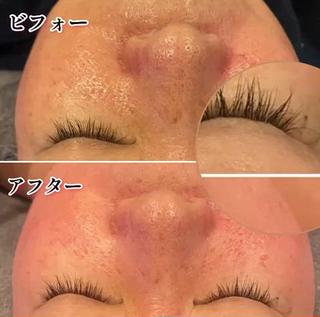 TEIKOKU所属・トータルビューティー TEIKOKUのエステ・リラクイメージ