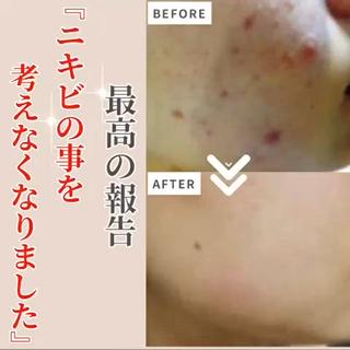 ニキビ・ 肌荒れ専門店のエステ・リラクイメージ