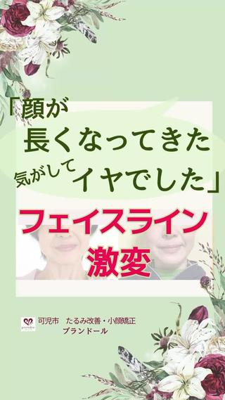 「顔が長くなった?!」
｢もっと短かったのに、いつの間に…?!」
と、お悩みの方はみえませんか?

実は気のせいではなく、実際ある事なのです。
年月や疲れを重ねるとお顔の骨格も変化が起きてきます。
そこに硬くなった筋肉や脂肪、むくみが乗っているため、
その変化が見ため的に大きくなります。
お顔の長さや幅についても同じ事が言えます。

逆を言えば、
そこを戻してあげると〇年か前のお顔に近づいていきます。

プランドールでは
オールハンドの癒しタッチで
そこを戻していく施術を行っています。

「打つ手がない｣
と諦めていらっしゃる方、
ぜひ一度お試しください.* 