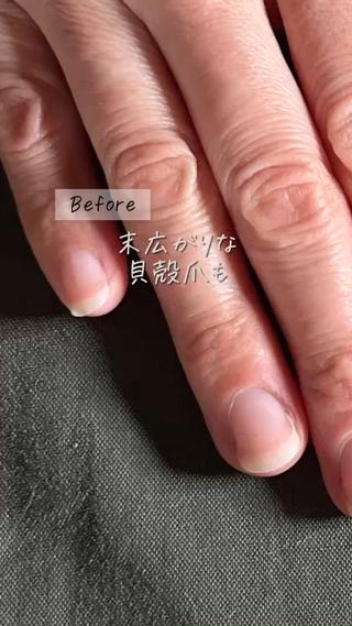 3ヶ月育成開始:1日目の施術