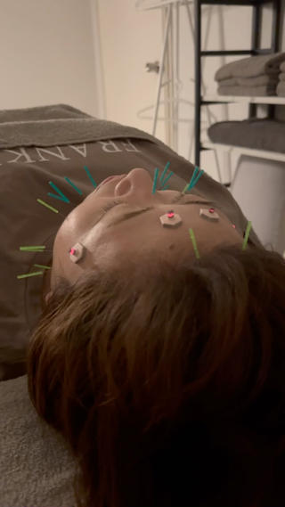 美容鍼×小顔矯正 ×美容整体　浜川泰仁のエステ・リラクイメージ