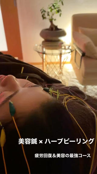 即小顔♥️美容鍼× ハーブピーリングのその他イメージ