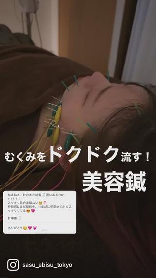 セミロング カラー パーマ ヘアアレンジ メンズ キッズ ネイル マツエク・マツパ アイブロウ 即小顔♥️美容鍼× ハーブピーリングのその他イメージ