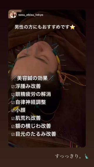 ショート カラー パーマ ヘアアレンジ メンズ キッズ ネイル マツエク・マツパ アイブロウ 即小顔♥️美容鍼× ハーブピーリングのその他イメージ