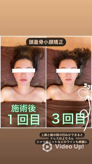 TOTAL BODY CARE SALON SUNNY所属・整体小顔･筋膜オイル ブライダルエステのエステ・リラクイメージ