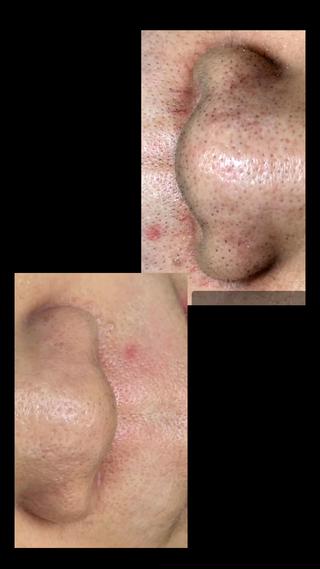 マリムーブフェイシャルワックス 