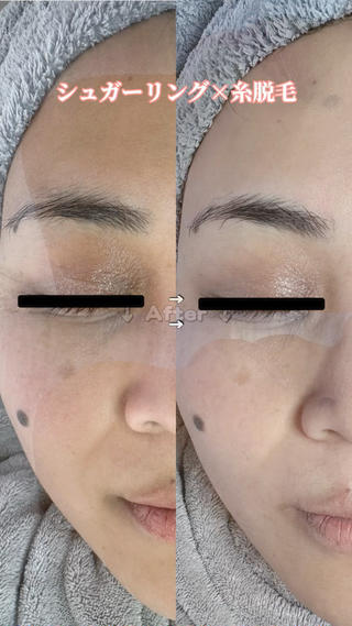 Hit. シュガーリング豊橋のエステ・リラクイメージ