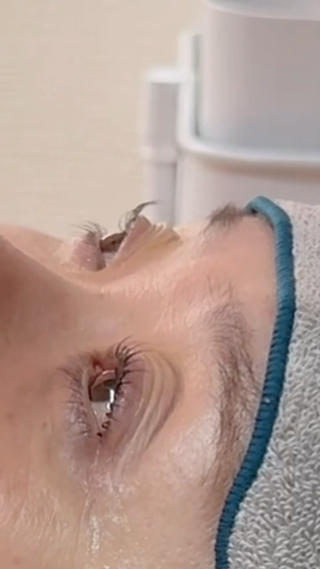 メーテル♡BeforeAfter 