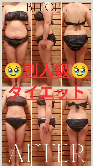 全身痩せ10回コース効果写真
#セルケア#セルライト#キャビテーション#EMS#全身痩せ#減量#ダイエット 