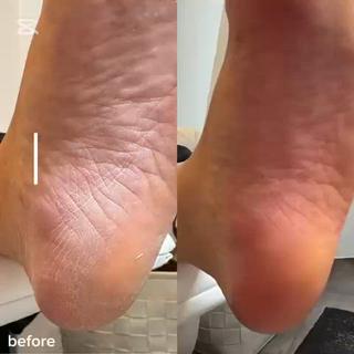 フットケア、before＆after
※お写真は一切無加工です。 