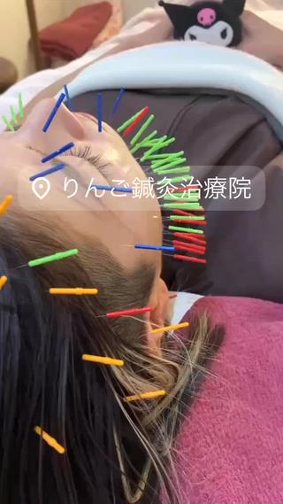美容鍼灸女性専用 りんご鍼灸治療院のその他イメージ