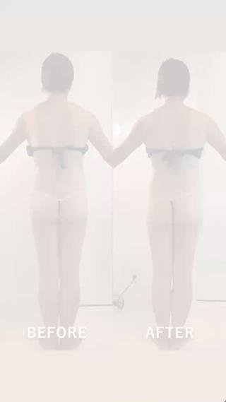 背中・腰まわり・脚のむくみまで、
しっかり流れてスッキリ
リンパの滞りが整うと、身体ってここまで変わります

背中のハリがやわらかく
ウエストラインがキュッと
 脚のラインがまっすぐに

「疲れてるけど、ちゃんと綺麗になりたい」
そんな方にこそ受けてほしい施術です

身体が軽くなると、気持ちまで前向きに。
あなたの“なりたい”を一緒に叶えます 