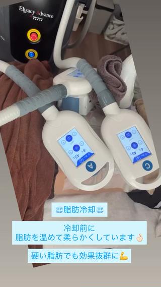 Miiju.所属・Miiju. 石巻市 脂肪冷却  鈴木のエステ・リラクイメージ