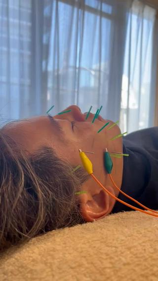 美容鍼×小顔×姿勢× ブライダル整体のエステ・リラクイメージ