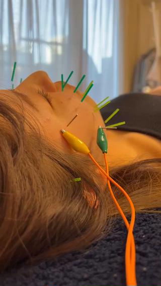 美容鍼×小顔×姿勢× ブライダル整体のエステ・リラクイメージ