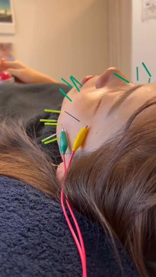 美容鍼×小顔×姿勢× ブライダル整体のエステ・リラクイメージ