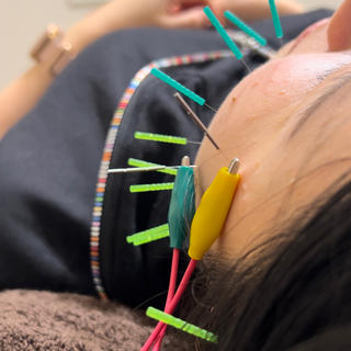 美容鍼×小顔×姿勢× ブライダル整体のエステ・リラクイメージ