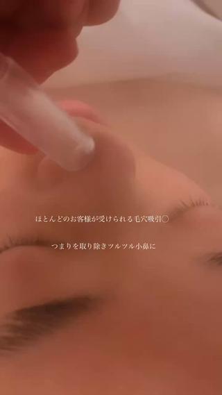 ほとんどのメニューに付いている角栓吸引。
これからの時期詰まりやすい毛穴のケアにオススメです♡ 